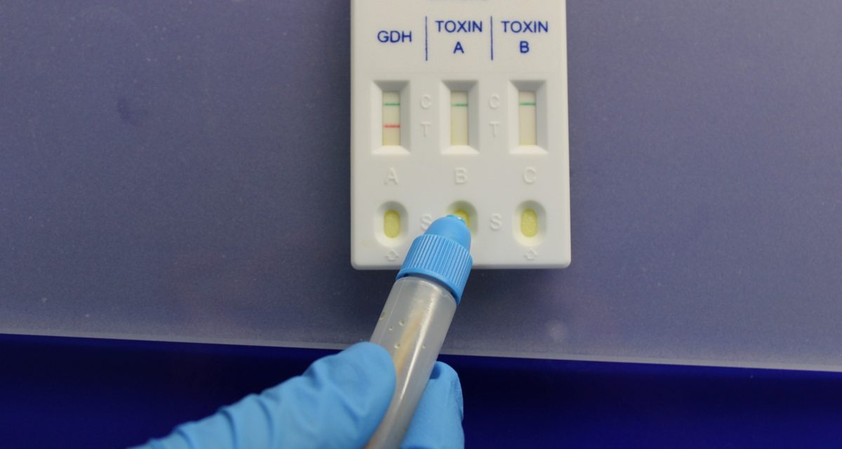 Klostridija (Clostridium difficile) bakterija – šta je i kada se radi test?