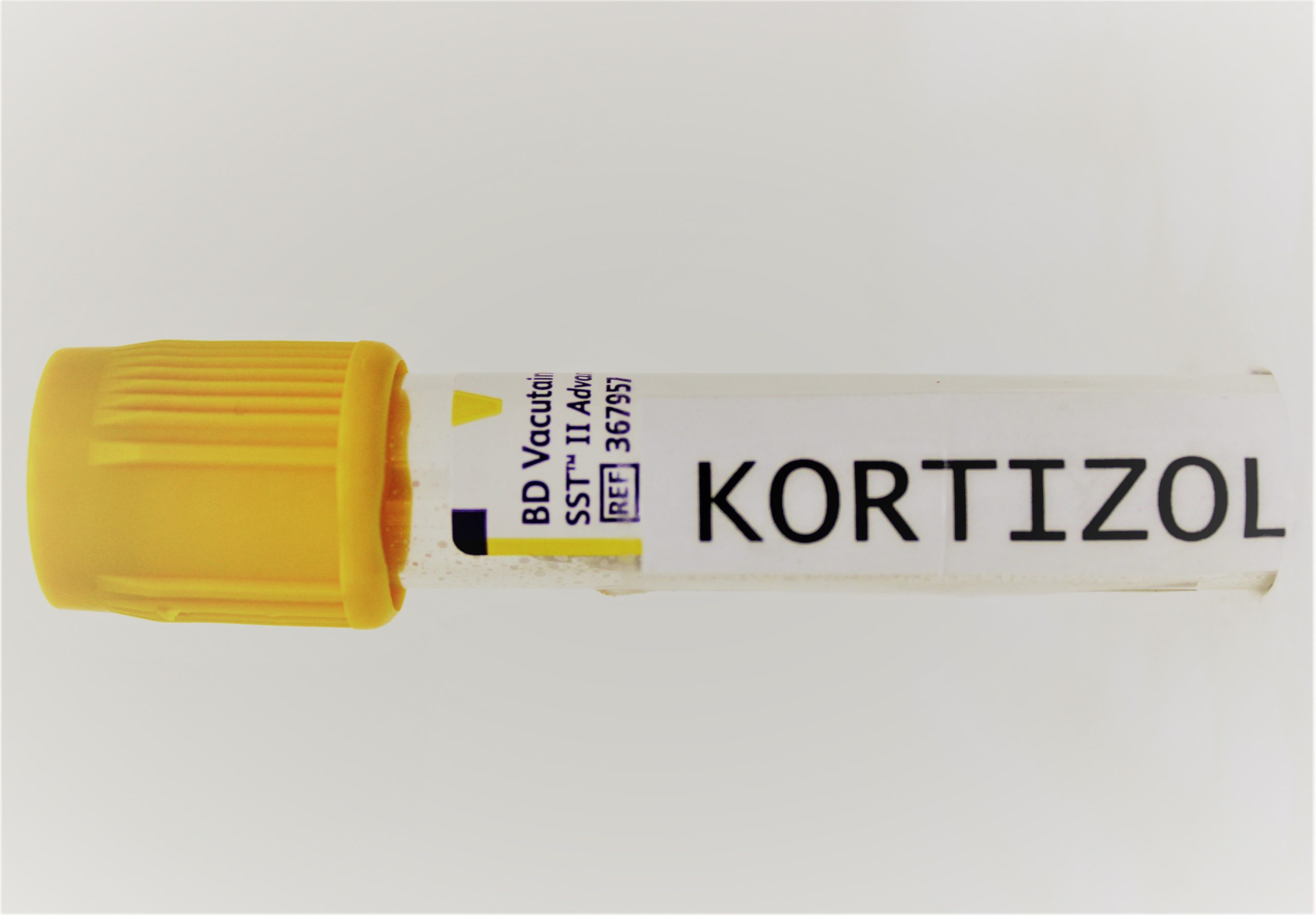 Kortizol BioDiagnostica Laboratorija Beograd Kortizol BioDiagnostica Laboratorija Beograd