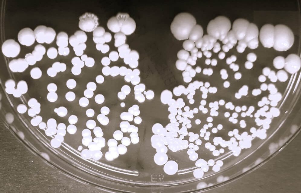 Kandida – sve što treba da znate o ovoj gljivičnoj infekciji