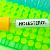 holesterol BioDiagnostica